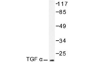 Image no. 1 for anti-Transforming Growth Factor, alpha (TGFA) antibody (ABIN271847) (TGFA Antikörper)
