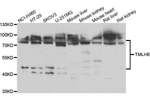 Western blot analysis of extracts of various cell lines, using TMLHE antibody. (TMLHE Antikörper)