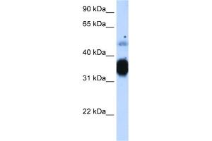 WB Suggested Anti-TNNT3 Antibody Titration:  1. (TNNT3 Antikörper  (N-Term))
