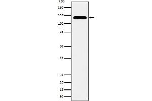 Western blot analysis of CYFIP1 expression in HeLa cell lysate. (Rekombinanter CYFIP1 Antikörper)
