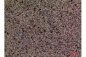 Immunohistochemistry (IHC) analysis of paraffin-embedded Human Spleen, antibody was diluted at 1:100.