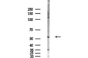 anti-Docking Protein 3 (DOK3) (Internal Region) antibody
