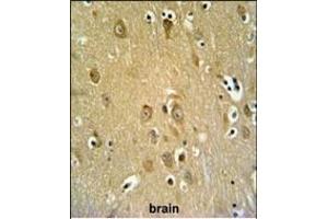 Immunohistochemistry (Paraffin-embedded Sections) (IHC (p)) image for anti-Synaptotagmin Like Protein 2 (SYTL2) (AA 840-868) antibody (ABIN650996)