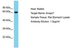 ANAPC7 Antikörper  (AA 387-436)