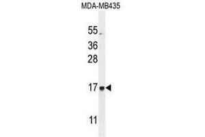 CU002 Antibody (C-term) western blot analysis in MDA-MB435 cell line lysates (35µg/lane). (C21orf2 Antikörper  (C-Term))