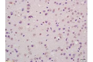 Formalin-fixed and paraffin embedded mouse brain labeled with Rabbit Anti-P73 protein Polyclonal Antibody, Unconjugated  at 1:200 followed by conjugation to the secondary antibody and DAB staining (Tumor Protein p73 Antikörper  (AA 501-631))