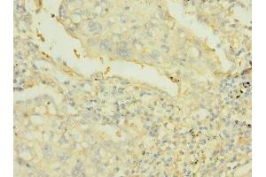 Immunohistochemistry (IHC) image for anti-Protein tyrosine Phosphatase, Receptor Type, J (PTPRJ) (AA 140-370) antibody (ABIN7167504)