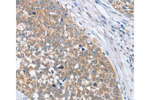 Immunohistochemistry (IHC) image for anti-3'-phosphoadenosine 5'-phosphosulfate Synthase 1 (PAPSS1) antibody (ABIN2422763) (PAPSS1 Antikörper)