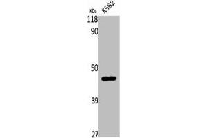 Western Blot analysis of K562 cells using β-1,4-Gal-T5 Polyclonal Antibody (B4GALT5 Antikörper  (C-Term))