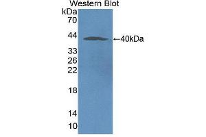 Western blot analysis of the recombinant protein. (NOX5 Antikörper  (AA 456-765))