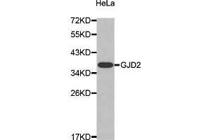 Western Blotting (WB) image for anti-Gap Junction Protein, delta 2, 36kDa (GJD2) (AA 99-197) antibody (ABIN3016909) (GJD2 Antikörper  (AA 99-197))
