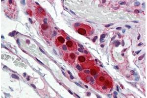 Immunohistochemistry (Formalin-fixed Paraffin-embedded Sections) (IHC (fp)) image for anti-ELAV (Embryonic Lethal, Abnormal Vision, Drosophila)-Like 4 (Hu Antigen D) (ELAVL4) (AA 312-381) antibody (ABIN790521)