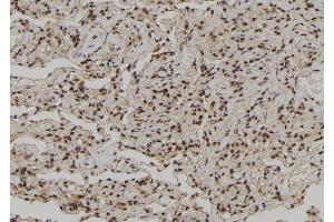 ABIN6272261 at 1/100 staining Human lung tissue by IHC-P. (CEBPZ Antikörper  (N-Term))