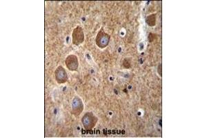 K6 Antibody (Center) (ABIN656098 and ABIN2845441) immunohistochemistry analysis in formalin fixed and raffin embedded human brain tissue followed by peroxidase conjugation of the secondary antibody and DAB staining. (PAK6 Antikörper  (AA 268-297))