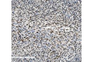 anti-Methyltransferase Like 1 (METTL1) (AA 2-276) antibody