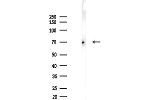 Western blot analysis of lysates from B16F10-LUC cells(UV,30 min treatment), using Phospho-YAP (s397) Antibody at 1/1000 dilution.