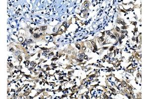 IHC analysis of IRF1 using anti-IRF1 antibody (ABIN7600281). (IRF1 Antikörper  (AA 170-315))