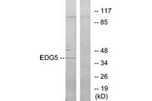 Western blot analysis of extracts from COLO205 cells, using EDG5 Antibody. (S1PR2 Antikörper  (AA 261-310))