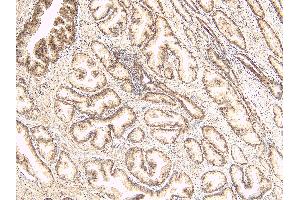 ABIN334520 (8µg/ml) staining of paraffin embedded Human Prostate. (TUSC3 Antikörper  (Internal Region))