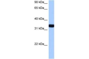 Western Blotting (WB) image for anti-GTPase, IMAP Family Member 1 (GIMAP1) antibody (ABIN2463329) (GTPase, IMAP Family Member 1 (GIMAP1) Antikörper)
