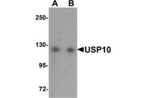 Western blot analysis of USP10 in Jurkat cell lysate with USP10 antibody at (A) 1 and (B) 2 μg/ml.