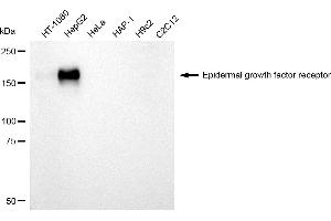 Western blotting analysis using Epidermal growth factor receptor antibody (ABIN7798477). (EGFR Antikörper)