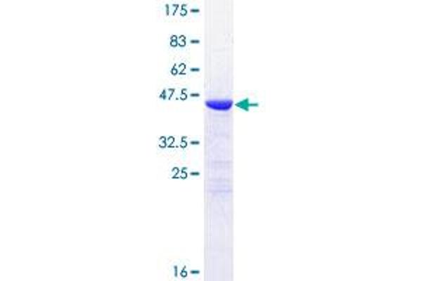 NCALD Protein (AA 1-193) (GST tag)