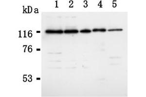 Western Blotting (WB) image for anti-RAD21 Homolog (RAD21) (AA 544-631), (C-Term) antibody (ABIN567792) (RAD21 Antikörper  (C-Term))