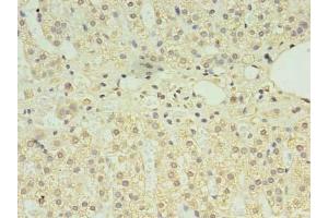 Immunohistochemistry of paraffin-embedded human adrenal gland tissue using ABIN7146897 at dilution of 1:100 (CLPB Antikörper  (AA 1-350))