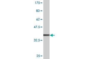 Western Blotting (WB) image for anti-Transporter 1, ATP-Binding Cassette, Sub-Family B (MDR/TAP) (TAP1) (AA 241-350) antibody (ABIN520696)