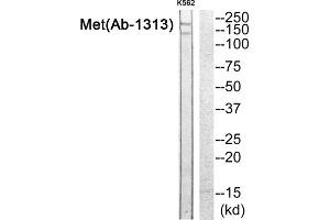 Western blot analysis of extracts from K562 cells, using Met (epitope around residue 1313) antibody. (c-MET Antikörper)