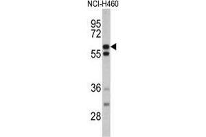 Western blot analysis of GNS antibody (Center S298) in NCI-H460 cell line lysates (35 µg/lane). (GNS Antikörper  (Middle Region))