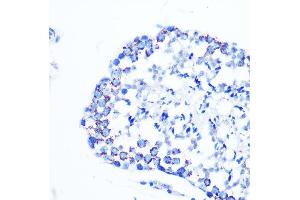 Immunohistochemistry of paraffin-embedded mouse testis using Monoamine Oxidase B (MAOB) (MAOB) Rabbit mAb (ABIN7268682) at dilution of 1:100 (40x lens). (Monoamine Oxidase B Antikörper)
