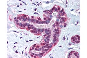 Anti-WRNIP1 / WHIP antibody IHC of human breast. (WRNIP1 Antikörper  (AA 67-116))