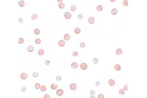 Immunohistochemistry (IHC) image for anti-Pappalysin 2 (PAPPA2) (N-Term) antibody (ABIN1031518) (PAPPA2 Antikörper  (N-Term))
