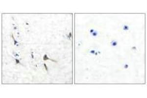 Immunohistochemical analysis of paraffin-embedded human brain tissue using Potassium Channel Kv3. (KCNC2 Antikörper)
