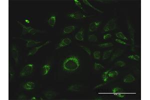 Immunofluorescence of purified MaxPab antibody to GSTK1 on HeLa cell. (GSTK1 Antikörper  (AA 1-226))