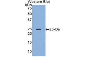 Western Blotting (WB) image for anti-Alcohol Dehydrogenase 1 (Class I) (ADH1) (AA 25-228) antibody (ABIN1857916)