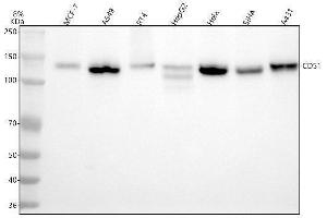 Western blot analysis of ITGAV using anti-ITGAV antibody (ABIN7602396).