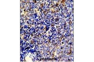 Immunohistochemistry (Paraffin-embedded Sections) (IHC (p)) image for anti-C-Mer Proto-Oncogene Tyrosine Kinase (MERTK) antibody (ABIN392343)