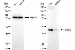 anti-Farnesyltransferase subunit beta (FNTB) antibody