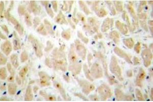 Immunohistochemistry (IHC) analyzes of MAPKAPK-2 antibody in paraffin-embedded human heart tissue. (MAPKAP Kinase 2 Antikörper)
