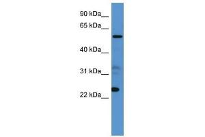 Western Blot showing CPNE9 antibody used at a concentration of 1-2 ug/ml to detect its target protein.