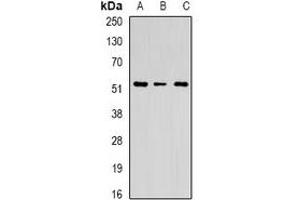 Western blot analysis of Chitotriosidase expression in U251 (A), HEK293T (B), mouse spleen (C) whole cell lysates. (Chitotriosidase 1 Antikörper)