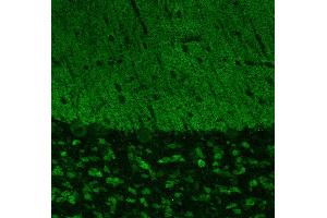 Indirect immunostaining of PFA fixed cerebellum sections (dilution 1 : 500). (SHANK3 Antikörper  (AA 1055-1616))