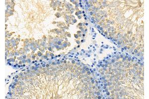 ABIN6265420 and ABIN6278637 at 1/100 staining Rat testis tissue by IHC-P. (TAAR3 Antikörper  (Internal Region))