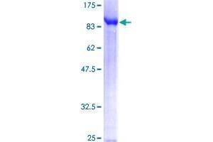 TDP1 Protein (AA 1-608) (GST tag)