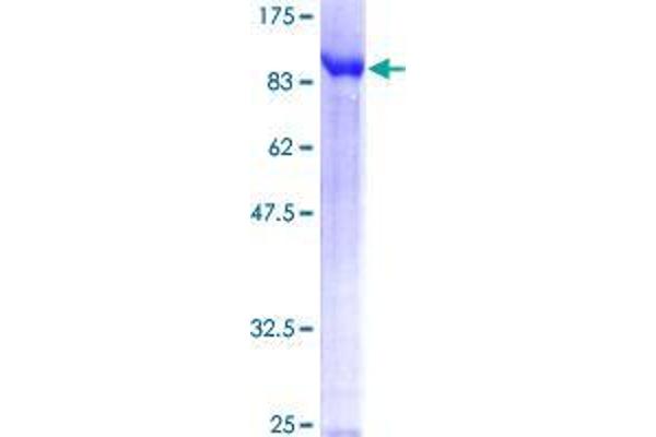 TDP1 Protein (AA 1-608) (GST tag)