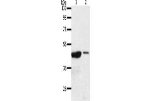 Gel: 10 % SDS-PAGE, Lysate: 40 μg, Lane 1-2: 231 cells, A549 cells, Primary antibody: ABIN7189569(AADACL4 Antibody) at dilution 1/100, Secondary antibody: Goat anti rabbit IgG at 1/8000 dilution, Exposure time: 30 minutes (AADACL4 Antikörper)
