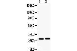 Western Blotting (WB) image for anti-Insulin-Like Growth Factor Binding Protein 1 (IGFBPI) (AA 177-207), (C-Term) antibody (ABIN3042732) (IGFBPI Antikörper  (C-Term))